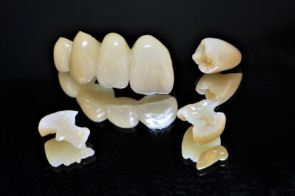 Emax（イーマックス）