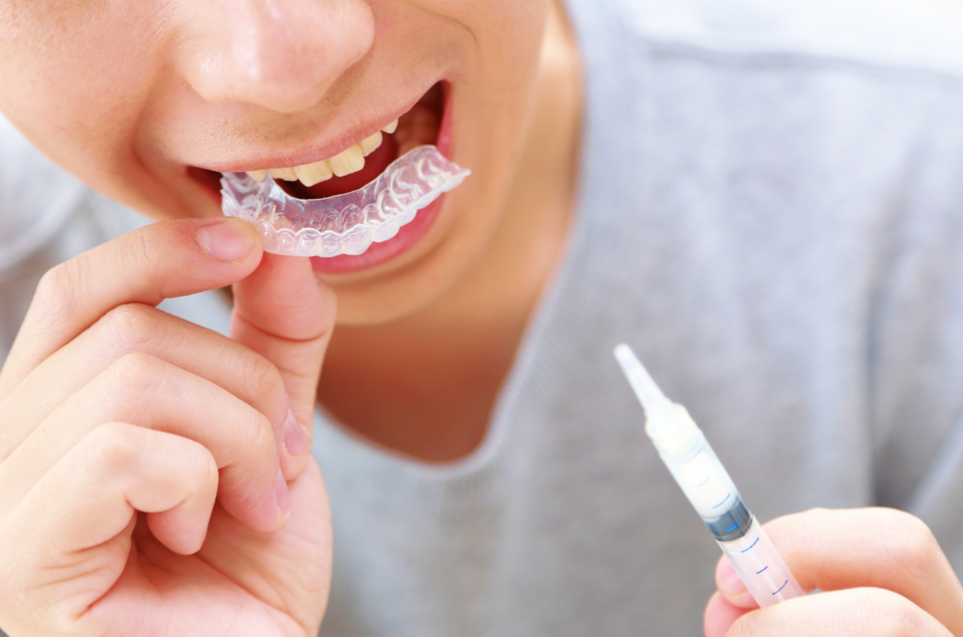 ホワイトニング